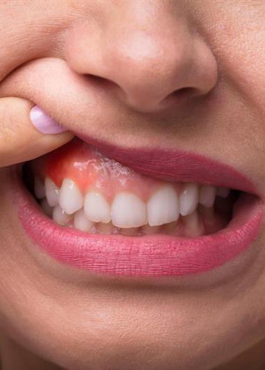 Periodontia - Imagem de Seção