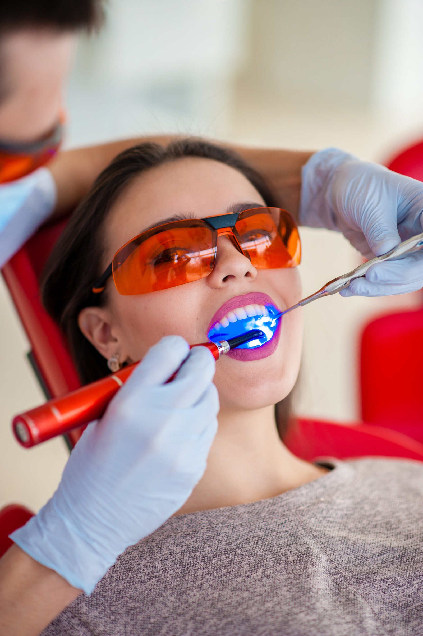 Estética Dental - Imagem de Seção